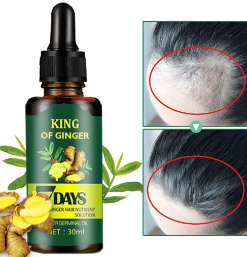 Sérum Capillaire au Gingembre 30 ml – Soin du Cuir Chevelu